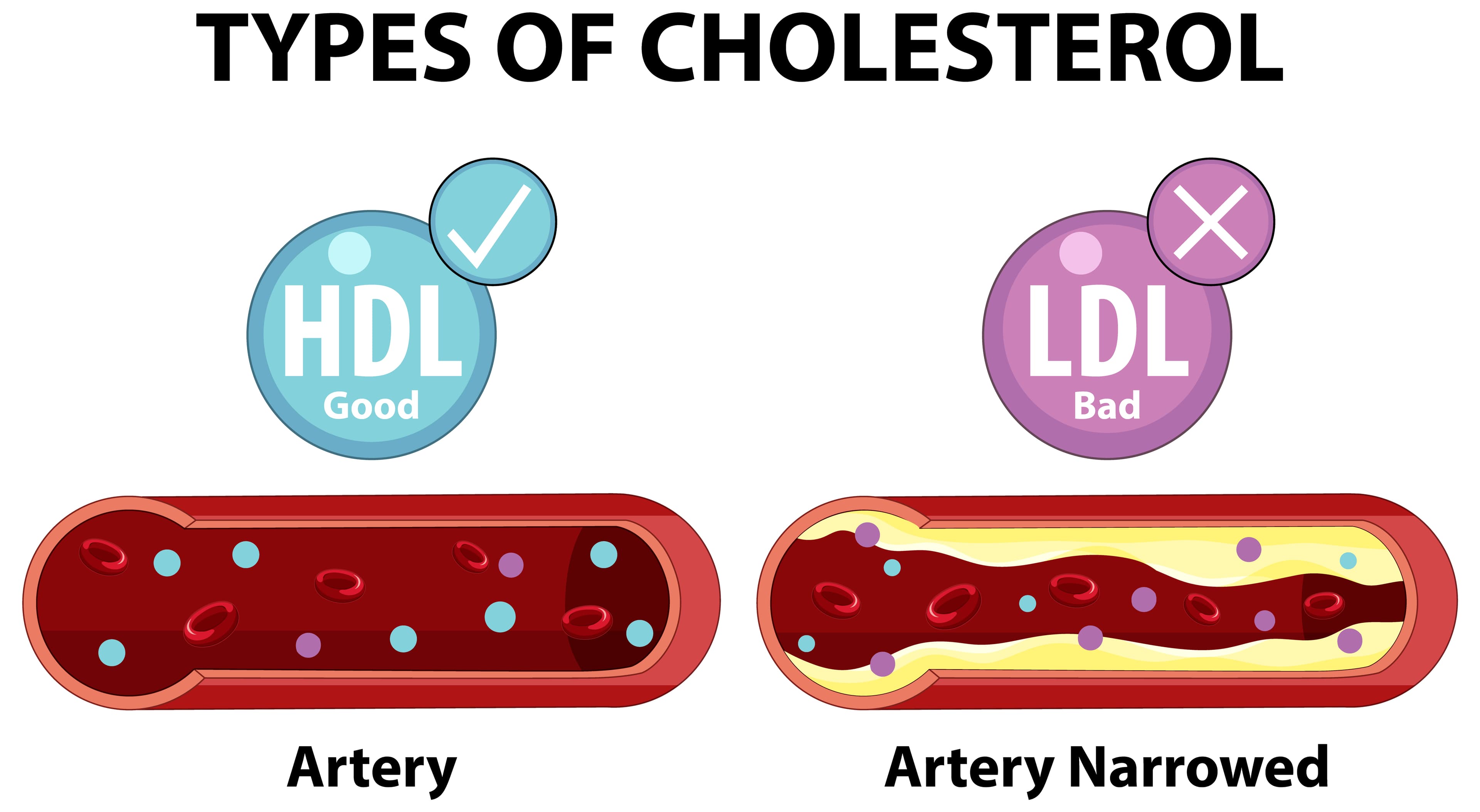 LDL vs HDL Cholesterol — What's the Difference?