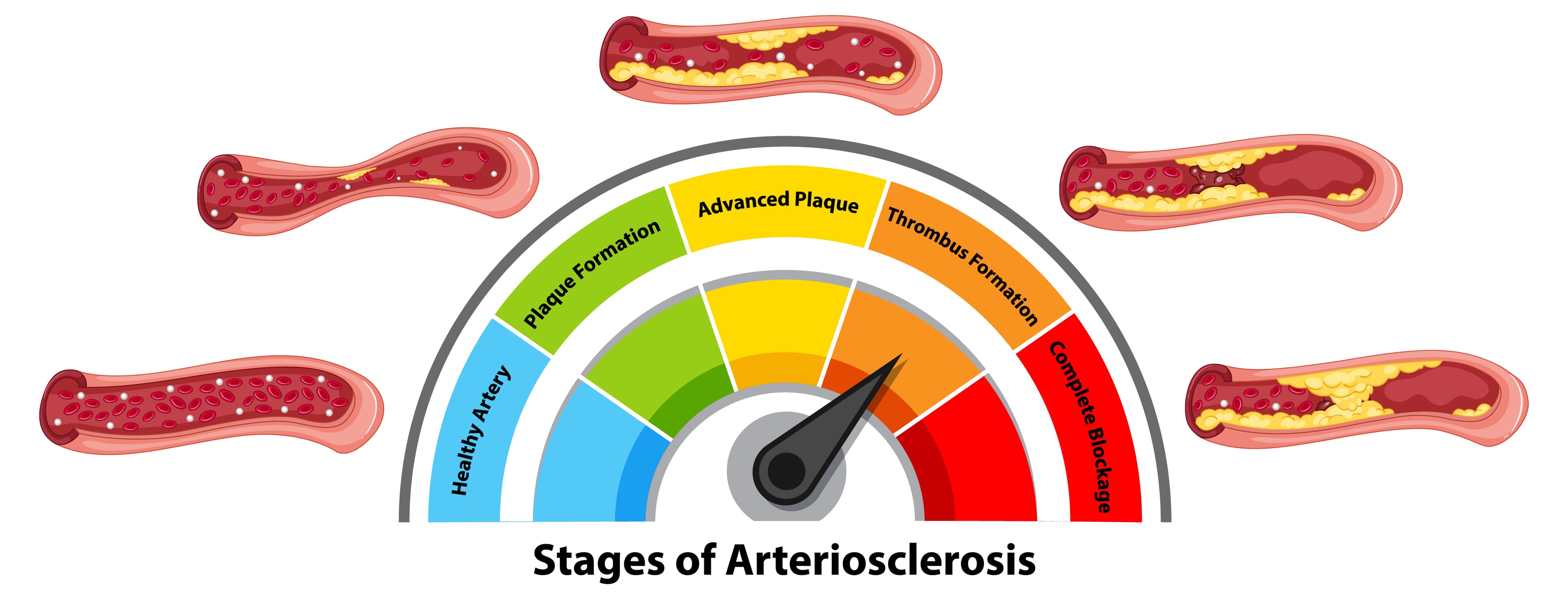 Normal Cholesterol Levels Chart